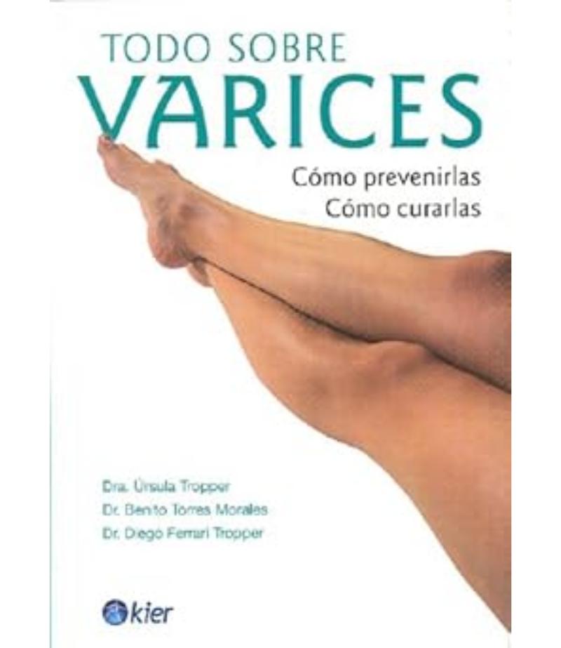 TODO SOBRE VARICES