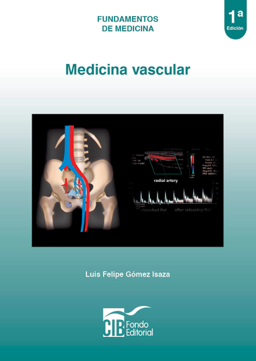 MEDICINA VASCULAR, 1A ED. (EBOOK)