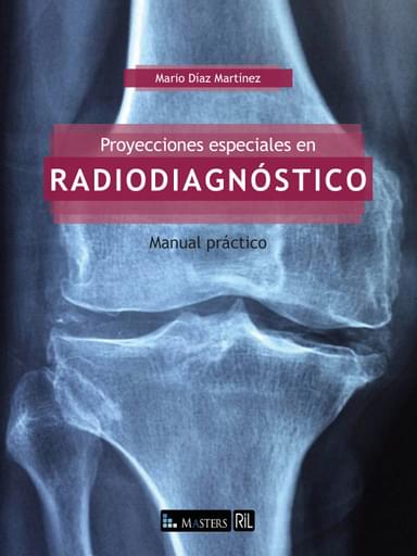 PROYECCIONES ESPECIALES EN RADIODIAGNÓSTICO (EBOOK)