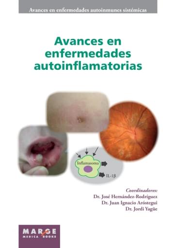 AVANCES EN ENFERMEDADES AUTOINFLAMATORIAS (EBOOK)
