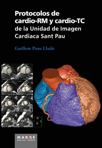 PROTOCOLOS DE CARDIO-RM Y CARDIO-TC DE LA UNIDAD DE IMAGEN CARDIACA SANT PAU (EBOOK)
