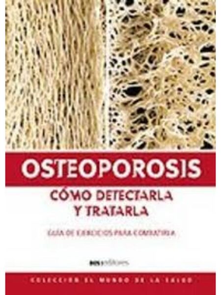 OSTEOPOROSIS CÓMO DETECTARLA Y TRATARLA