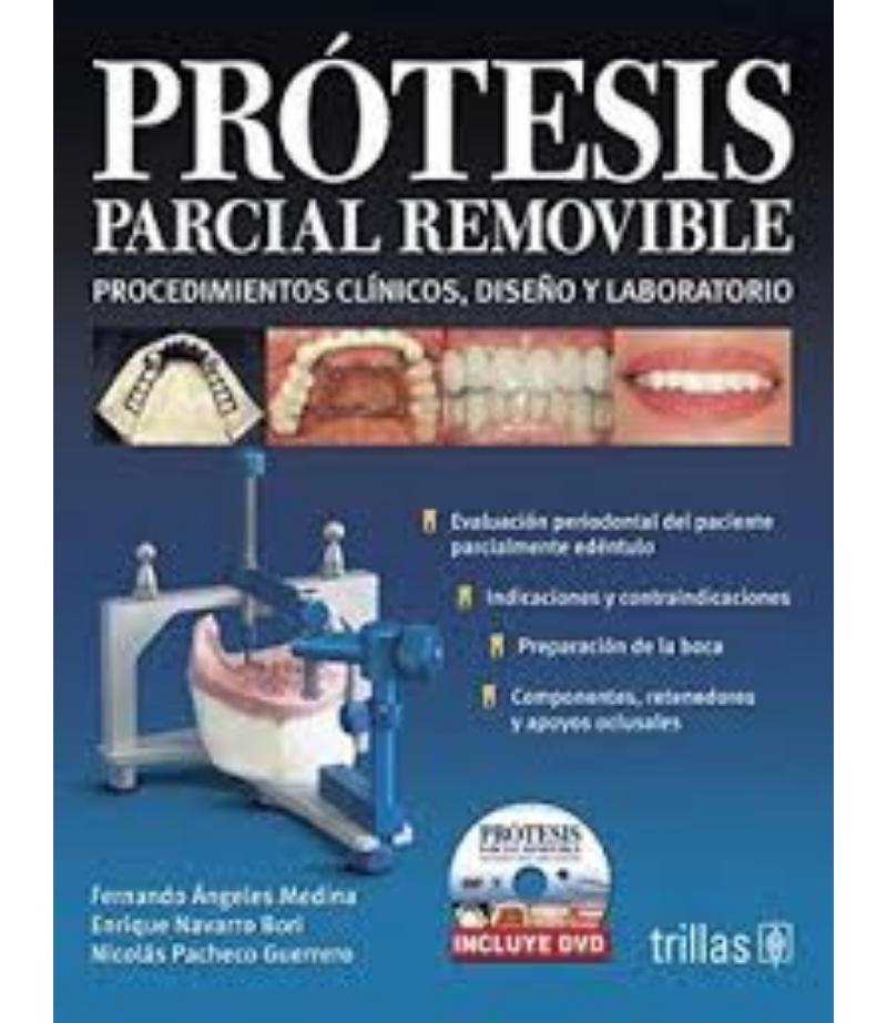 PRÓTESIS PARCIAL REMOVIBLE PROCEDIMIENTOS CLÍNICOS, DISEÑO Y LABORATORIO