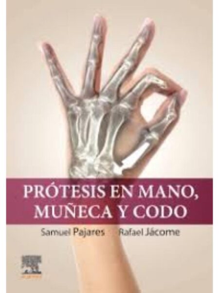 PRÓTESIS EN MANO, MUÑECA Y CODO